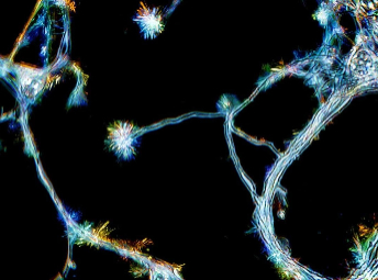 有证据证明成年人类也会萌发新脑细胞