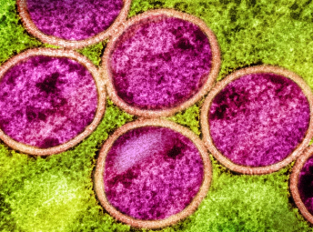 猴痘会再次在全球蔓延吗？