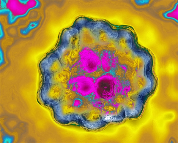 量子计算机首次加载完整基因组